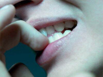 Как перестать грызть ногти. Поможем отучить и бросить грызть ногти