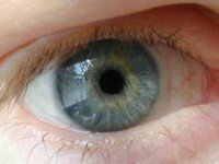 Как быстро избавиться от ячменя на глазу в домашних условиях